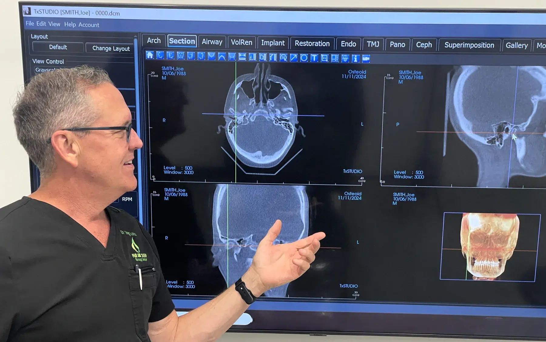 Dr. Greg Larson reviewing a CBCT scan in TxSTUDIO.